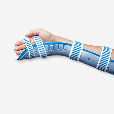 Ulnar gutter splint